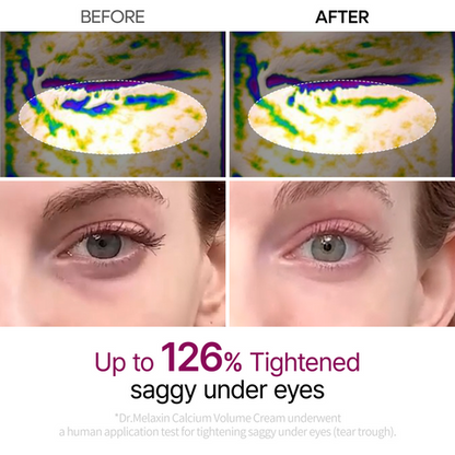 Dr.Melaxin Calcium Eye Care Line